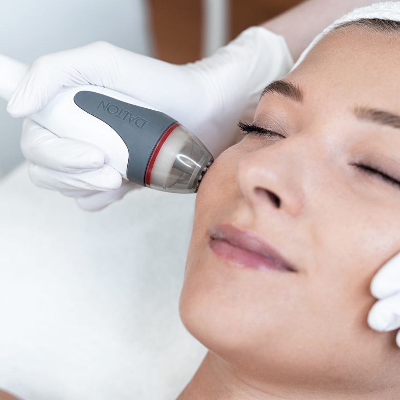 Aqua Facial