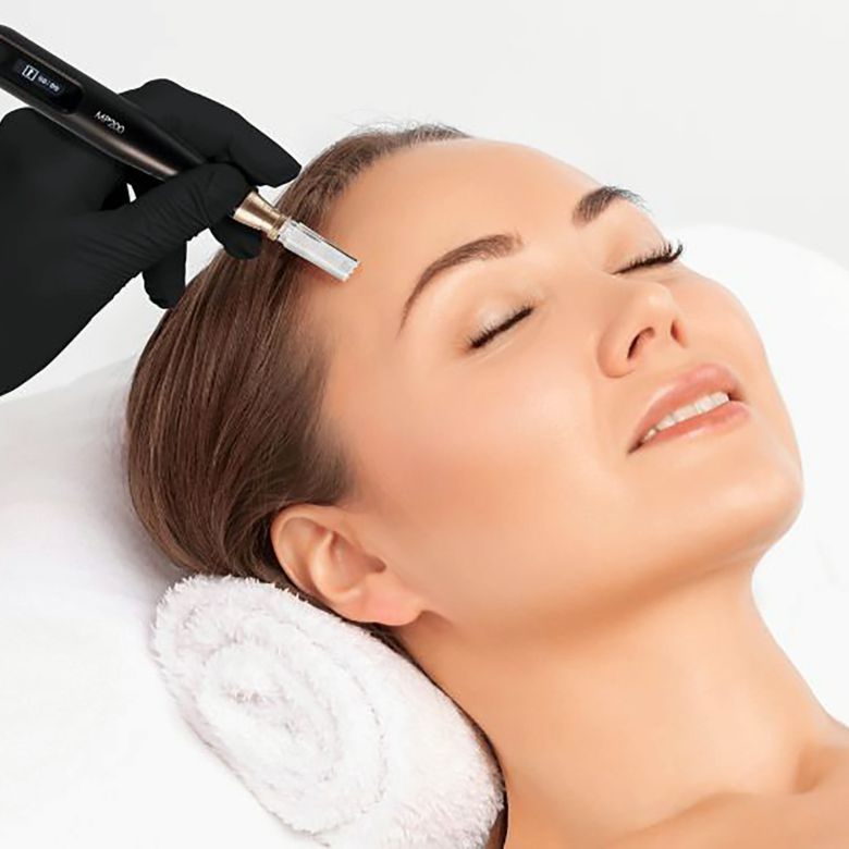 Microneedling Gesichtsbehandlung in Sylvia's Beauty Lounge